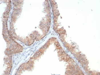 IL18 Antibody