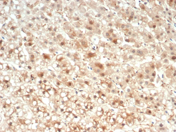 IL18 Antibody