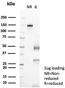 IL18 Antibody