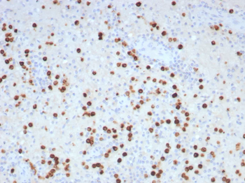 GLUL Antibody