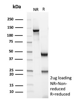 GLUL Antibody