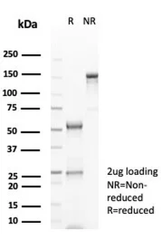 GFAP Antibody