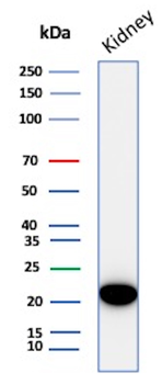 CRYAB Antibody