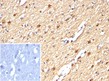 CKB Antibody