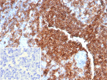 ENTPD1 Antibody