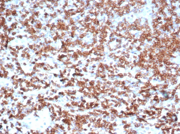 ENTPD1 Antibody