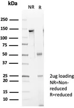ENTPD1 Antibody