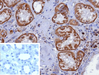 CD7 Antibody