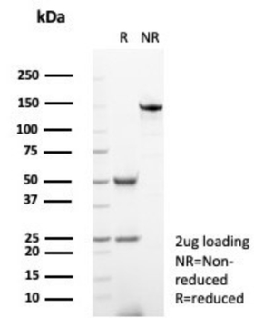 MGMT Antibody