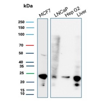MGMT Antibody