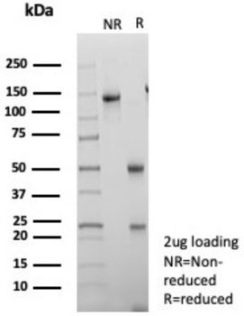 IGFBP3 Antibody