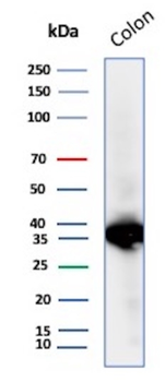 CNN1 Antibody