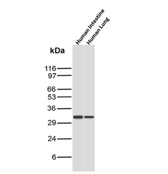CNN1 Antibody