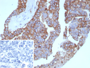 HLA-DPB1 Antibody