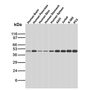 SMARCB1 Antibody
