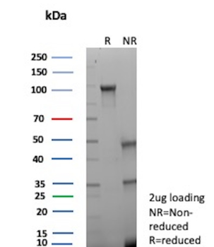 SMARCB1 Antibody