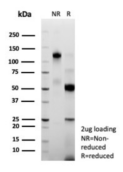 MGMT Antibody