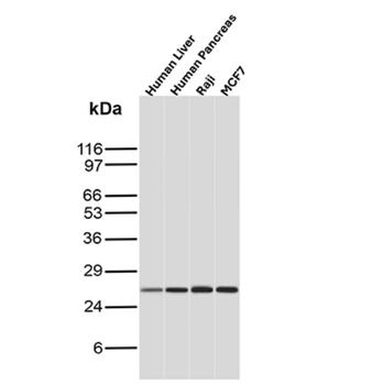 MGMT Antibody