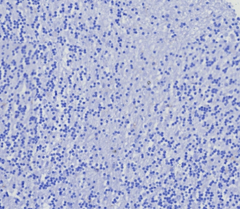 CD4 Antibody