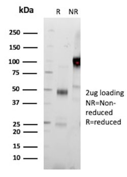 MS4A1 Antibody