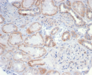 MS4A1 Antibody