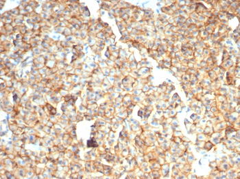 EPCAM Antibody