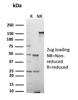 EPCAM Antibody