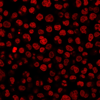 IgG1 Isotype Control for Mouse Antibody