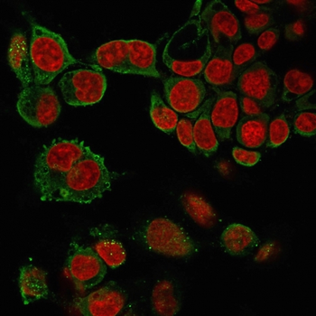 TNF Antibody