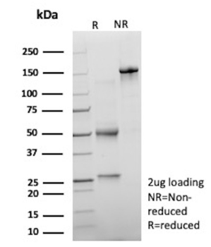 TNF Antibody