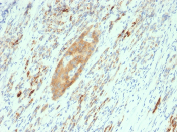 GAD2 Antibody