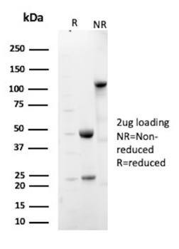 HLA-DPB1 Antibody
