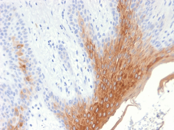 KRT10 Antibody