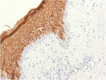 KRT10 Antibody