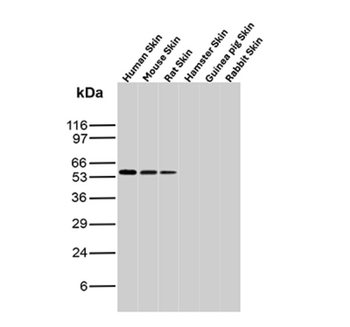 KRT10 Antibody
