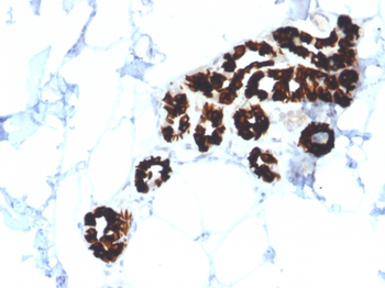 KRT15 Antibody