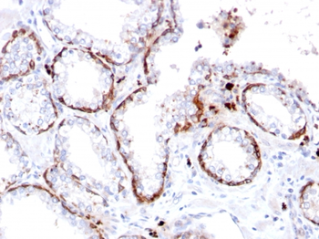 KRT15 Antibody