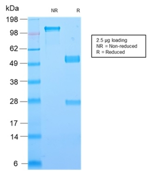 LGALS1 Antibody