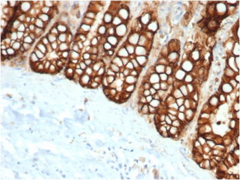 EPCAM Antibody