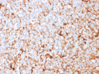 SCGB2A2 Antibody