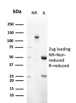 SCGB2A2 Antibody