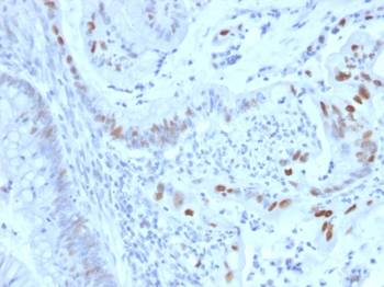 CCNE1 Antibody