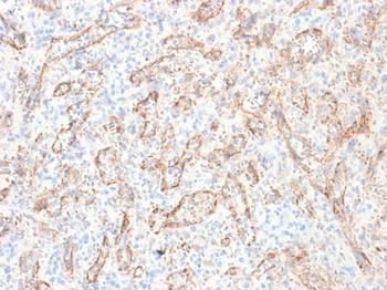 TNFSF15 Antibody