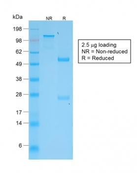 TNFSF15 Antibody