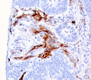 NES Antibody