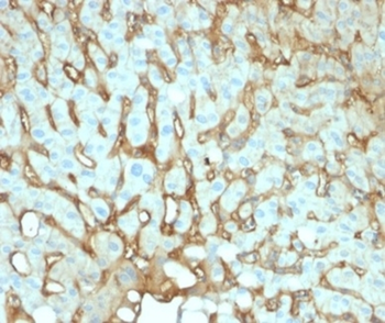 ALB Antibody
