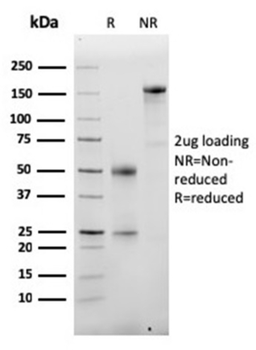 ALB Antibody
