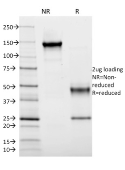 HLA-DRB1 Antibody