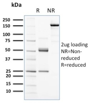 KIT Antibody