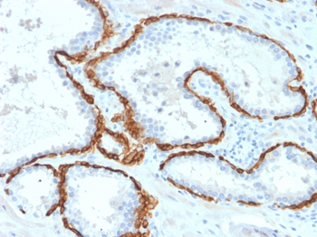 KRT15 Antibody